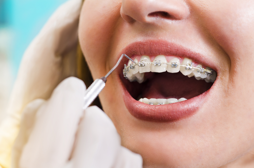 Latest Dental Blog