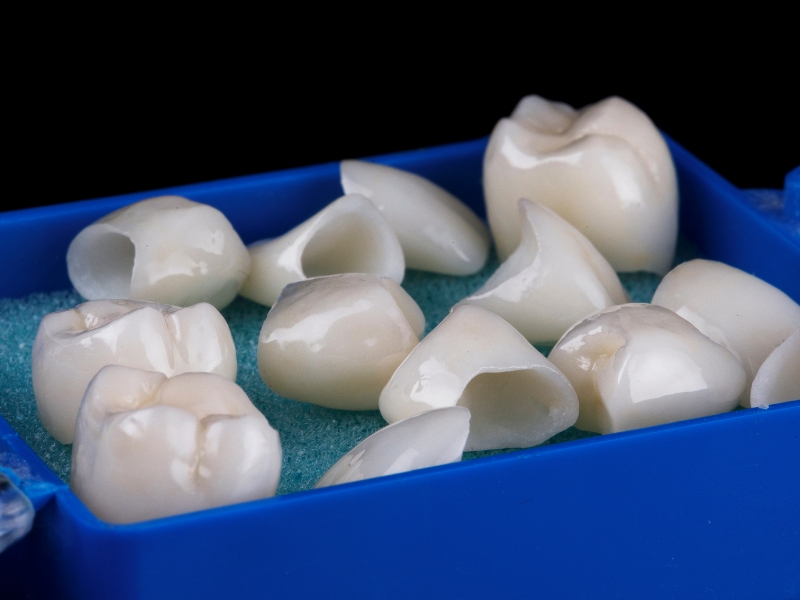 Multiple ceramic crowns used for emergency dental crown repair stored in blue dental tray