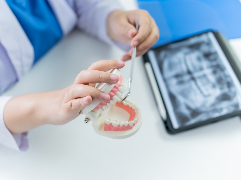 Dentist using model to explain guide to dental implants procedure.